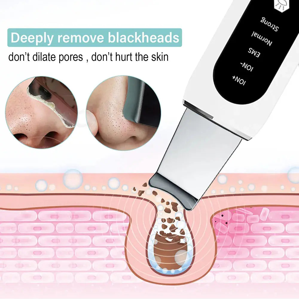 Ultrasonic Skin Scrubber: Peeling, Blackhead Remover & Tiefenreinigung - Raffiniertedinge Ultrasonic Skin Scrubber: Peeling, Blackhead Remover & Tiefenreinigung - Raffiniertedinge